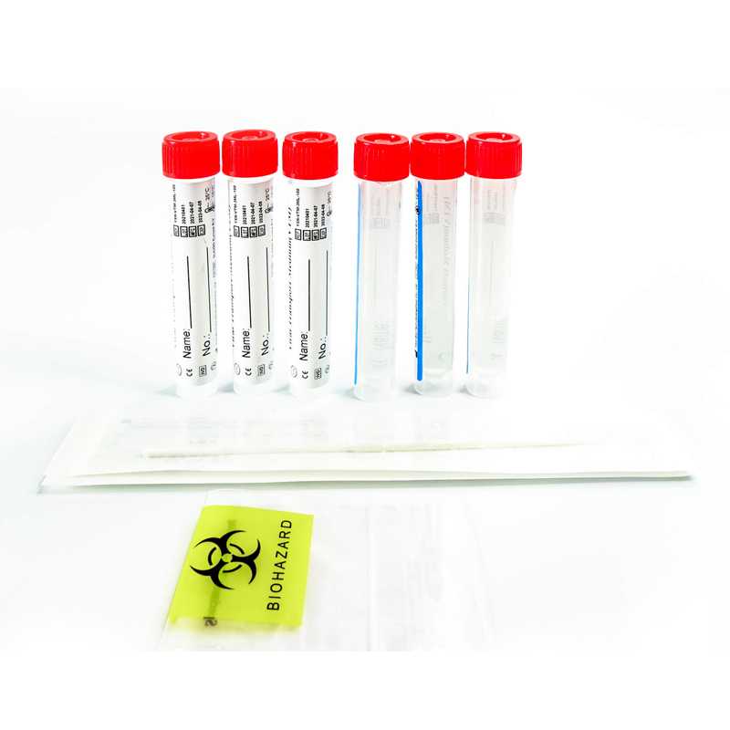 Virus Sample Release Reagent for PCR Detection Test Kit