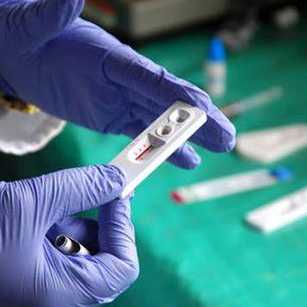 What are the HIV testing methods?