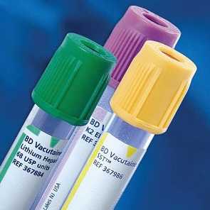 Summary of knowledge of different vacuum blood collection tubes
